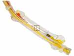 Thermostatic Fuse - 1034948 Thermal Fuse [Amica]